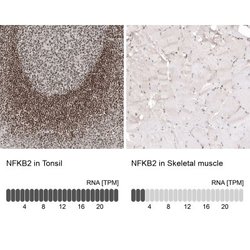 NFkB2/NFkB p100 Antibody (CL8266), Novus Biologicals 100 &mu;L; Unconjugated:Antibodies,